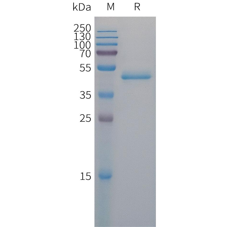 Human PAI1 Protein, His Tag