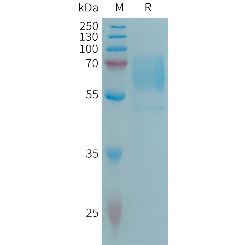 Human CD98 Protein, His Tag