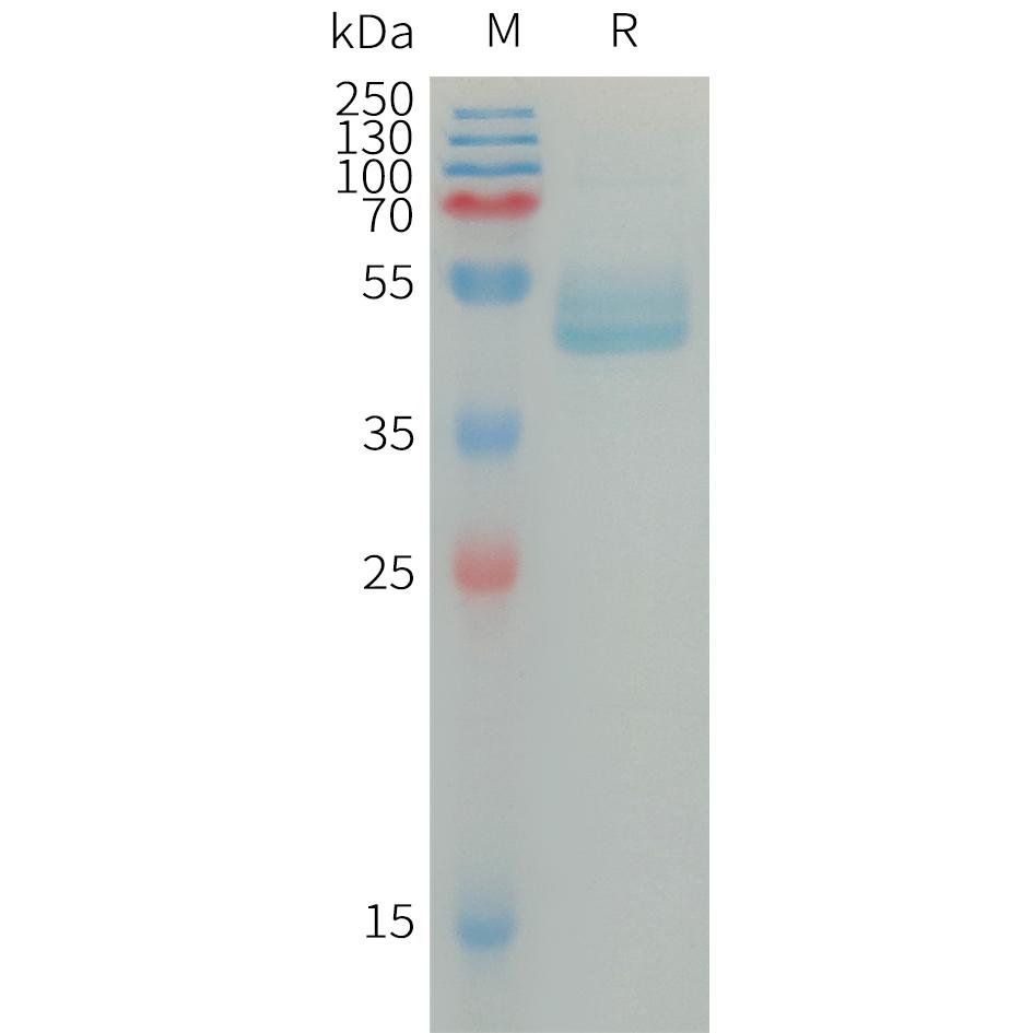 Human IL4 Protein, mFc Tag