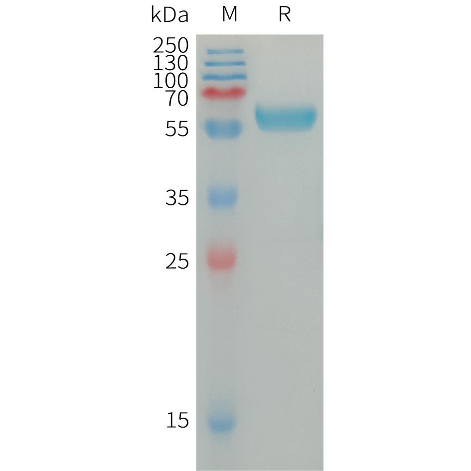 Human IGSF11 Protein, hFc Tag