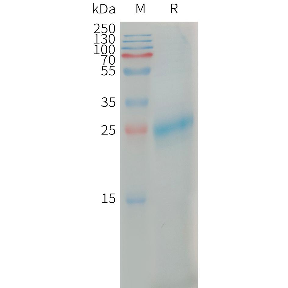 Human CLEC4C Protein, His Tag