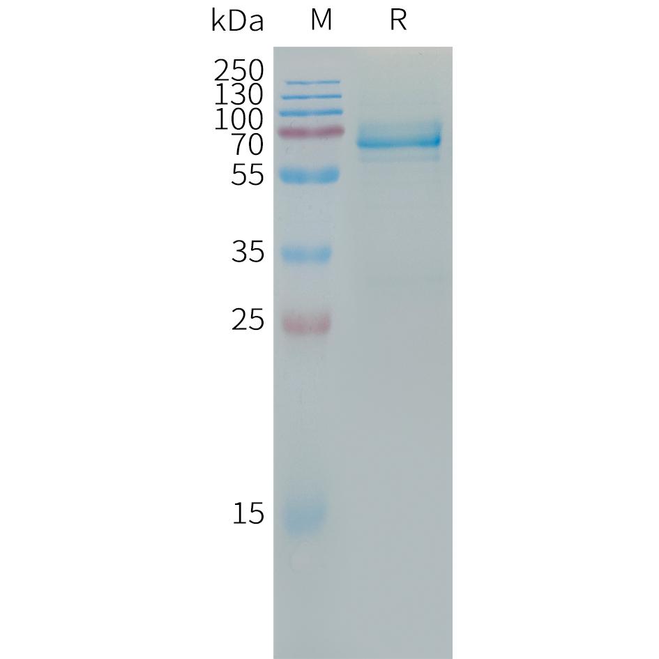 Human LILRB4 Protein, hFc Tag