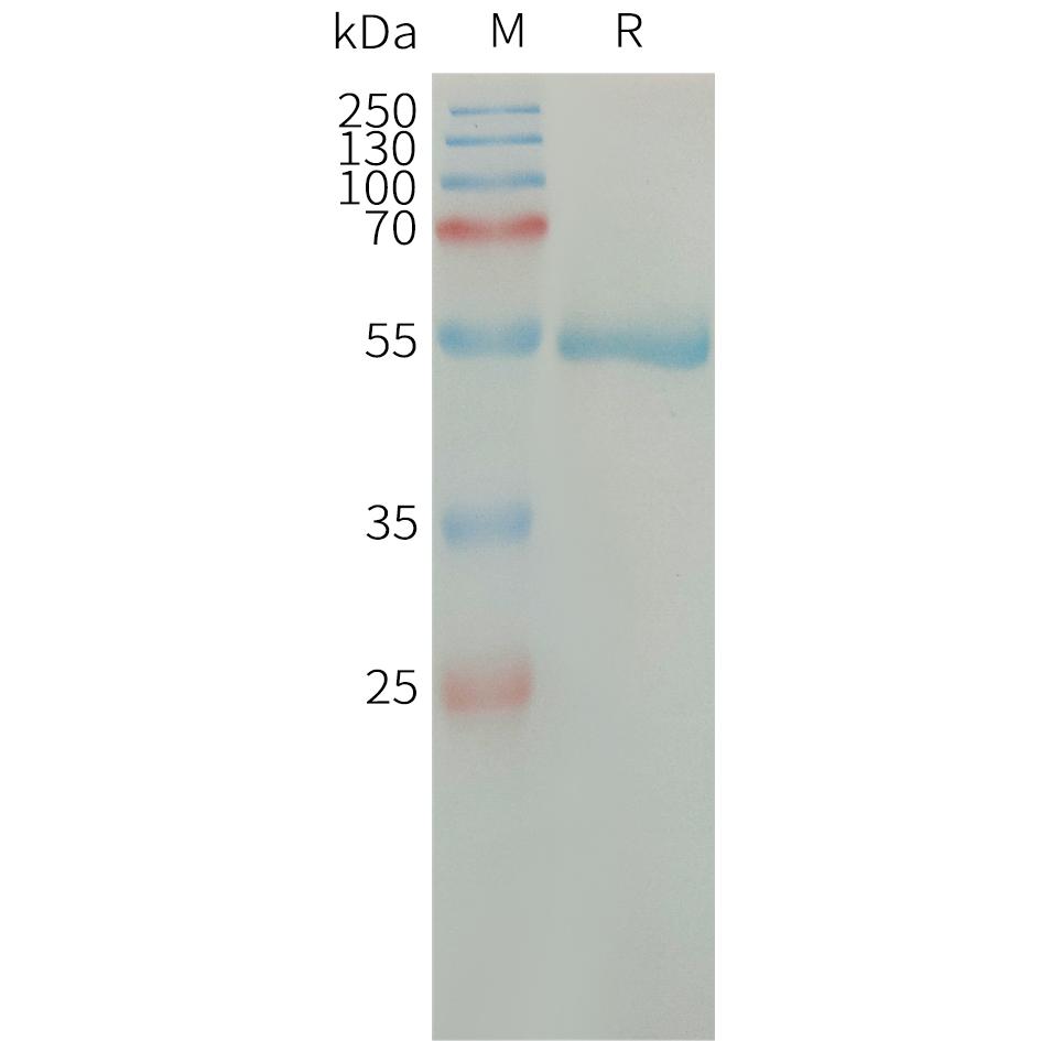 Human CFD Protein, hFc Tag