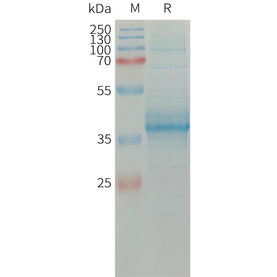 Human CCL11 Protein, hFc Tag