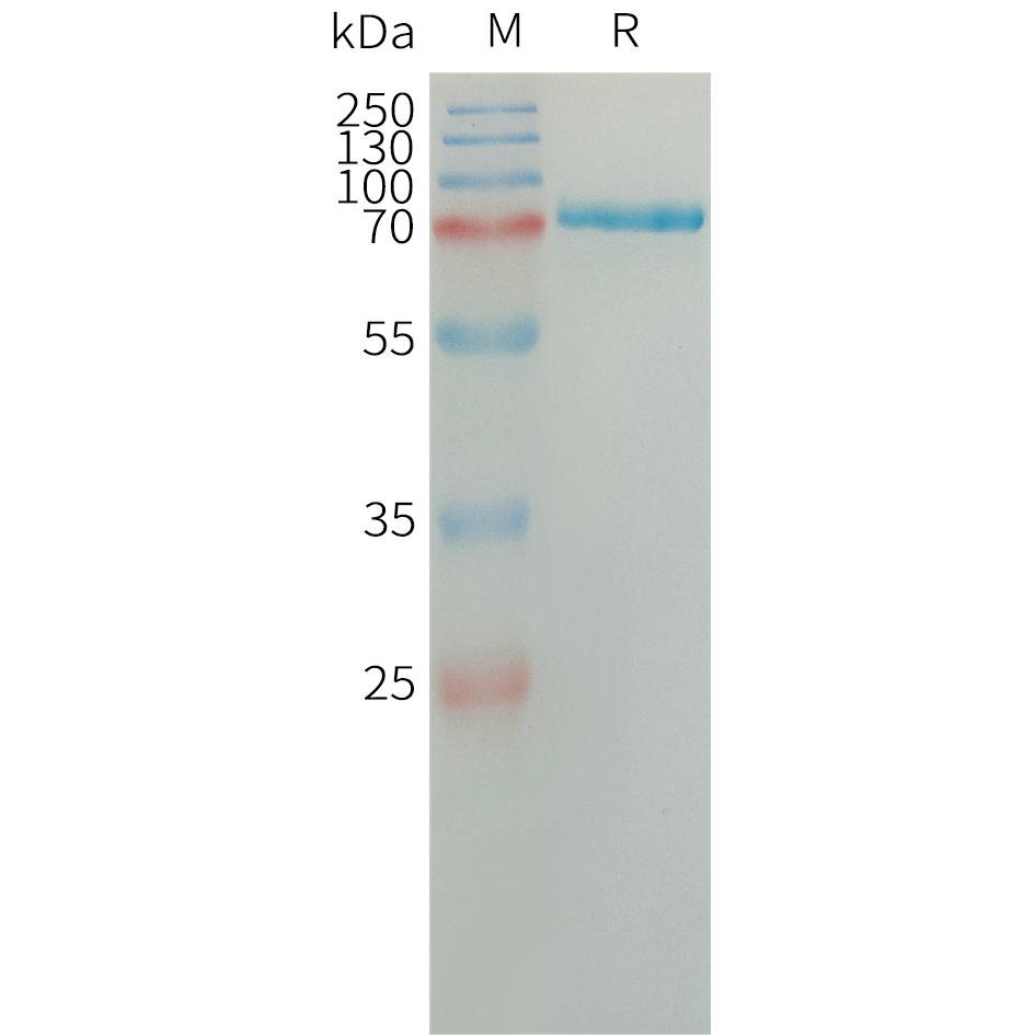 Human SEMA7A Protein, His Tag