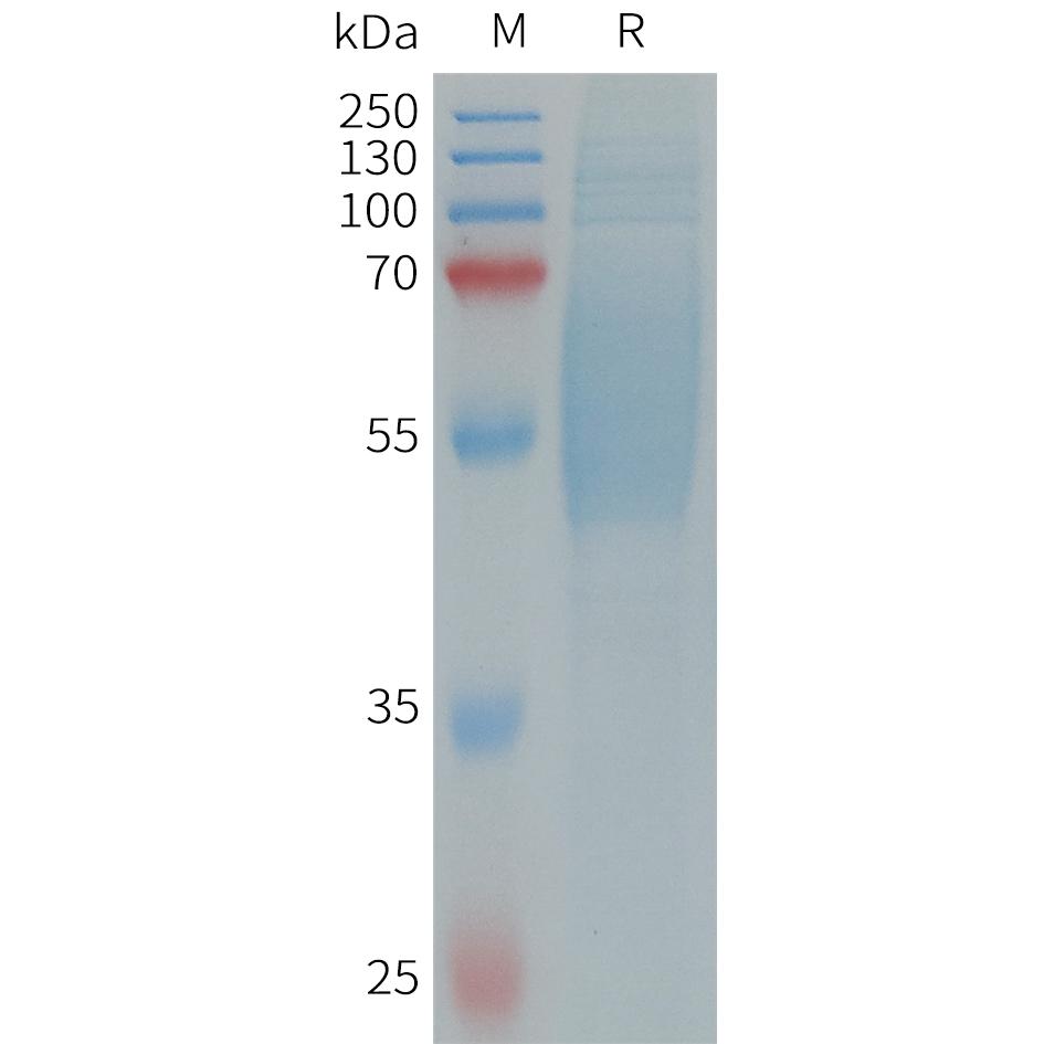 Human IL1RL2 Protein, His Tag