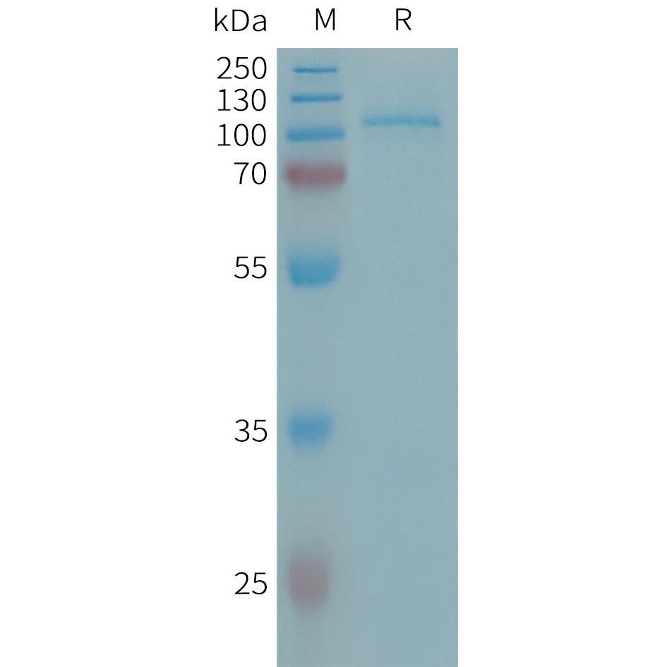 Human ENPP2 Protein, His Tag