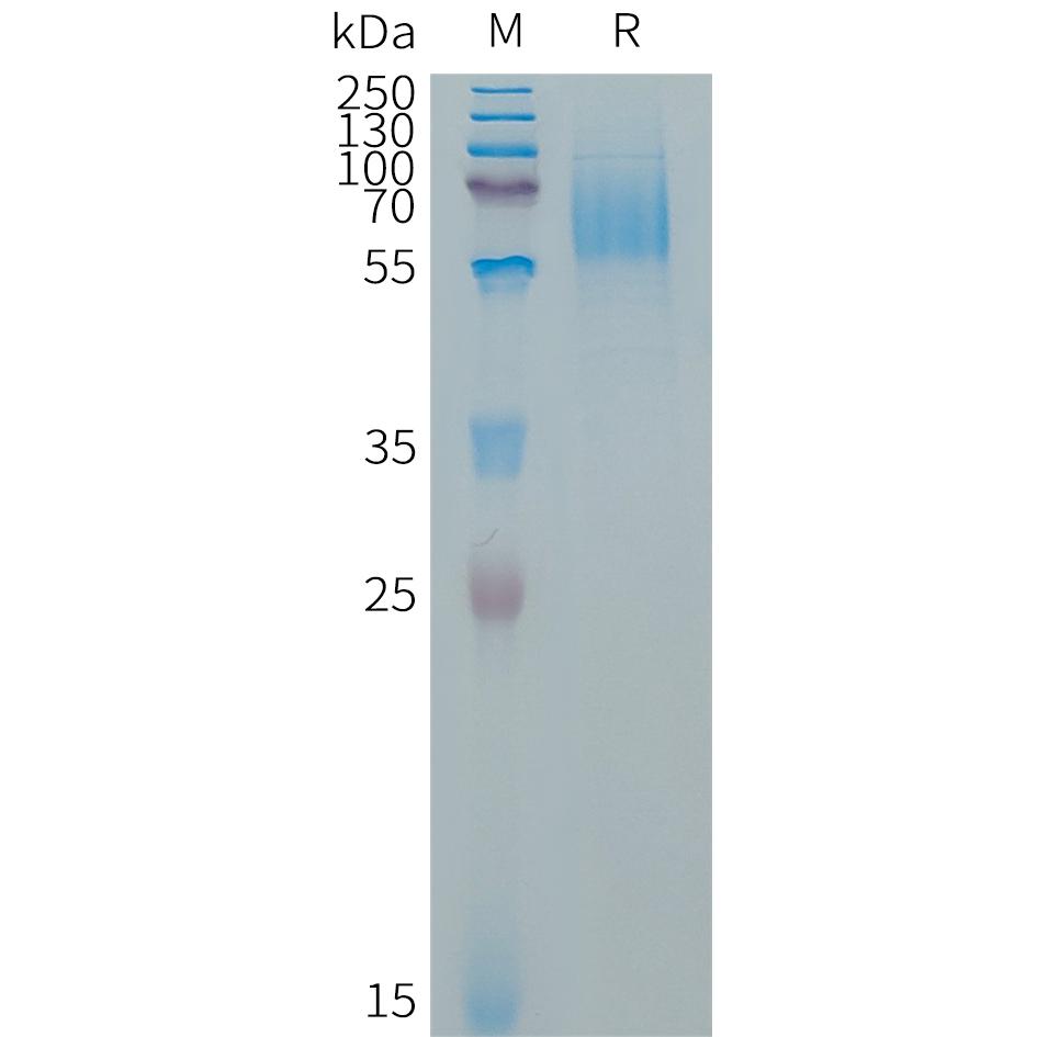 Human EGFRVIII Protein, His Tag