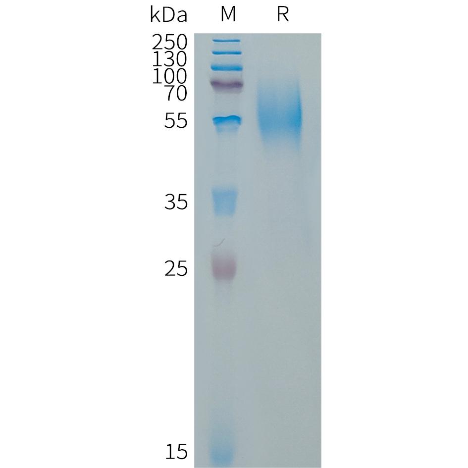 Human CD79A Protein, hFc Tag