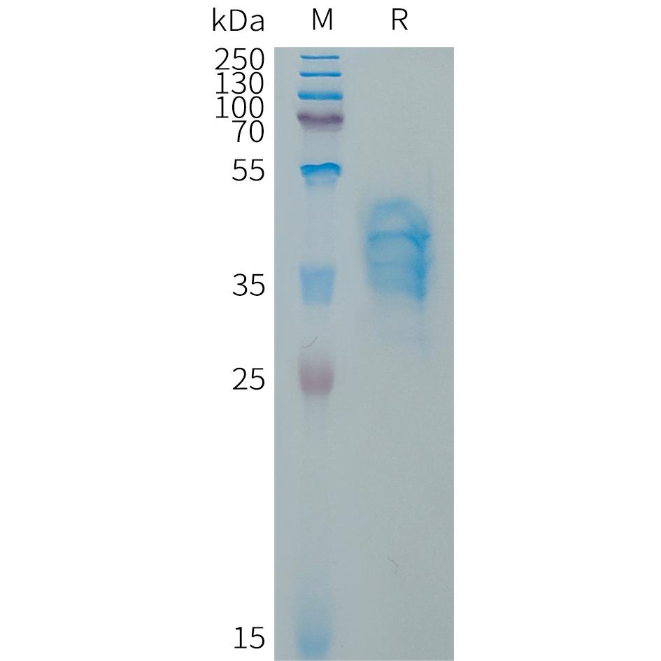 Human VWF(1596-1668) Protein, hFc Tag