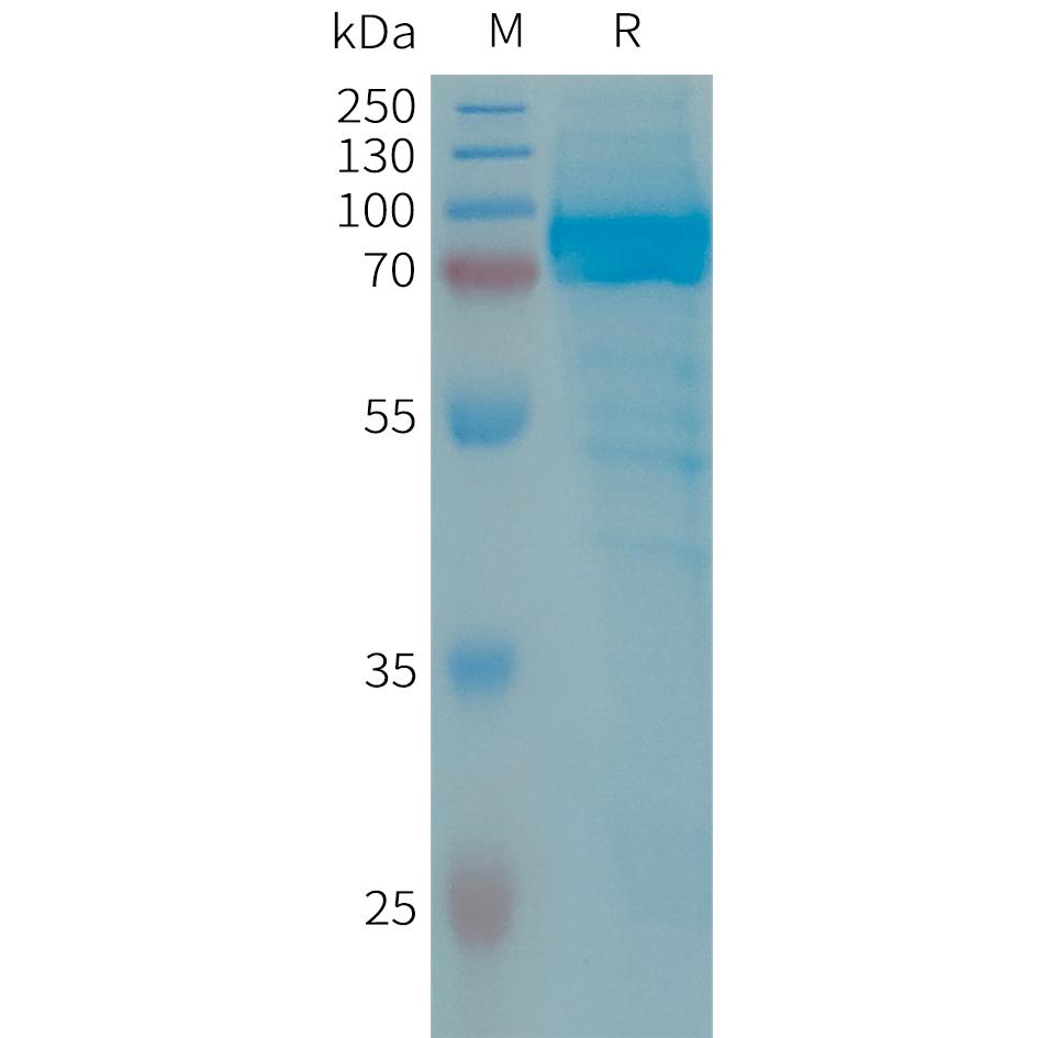 Human IL13RA2 Protein, hFc Tag