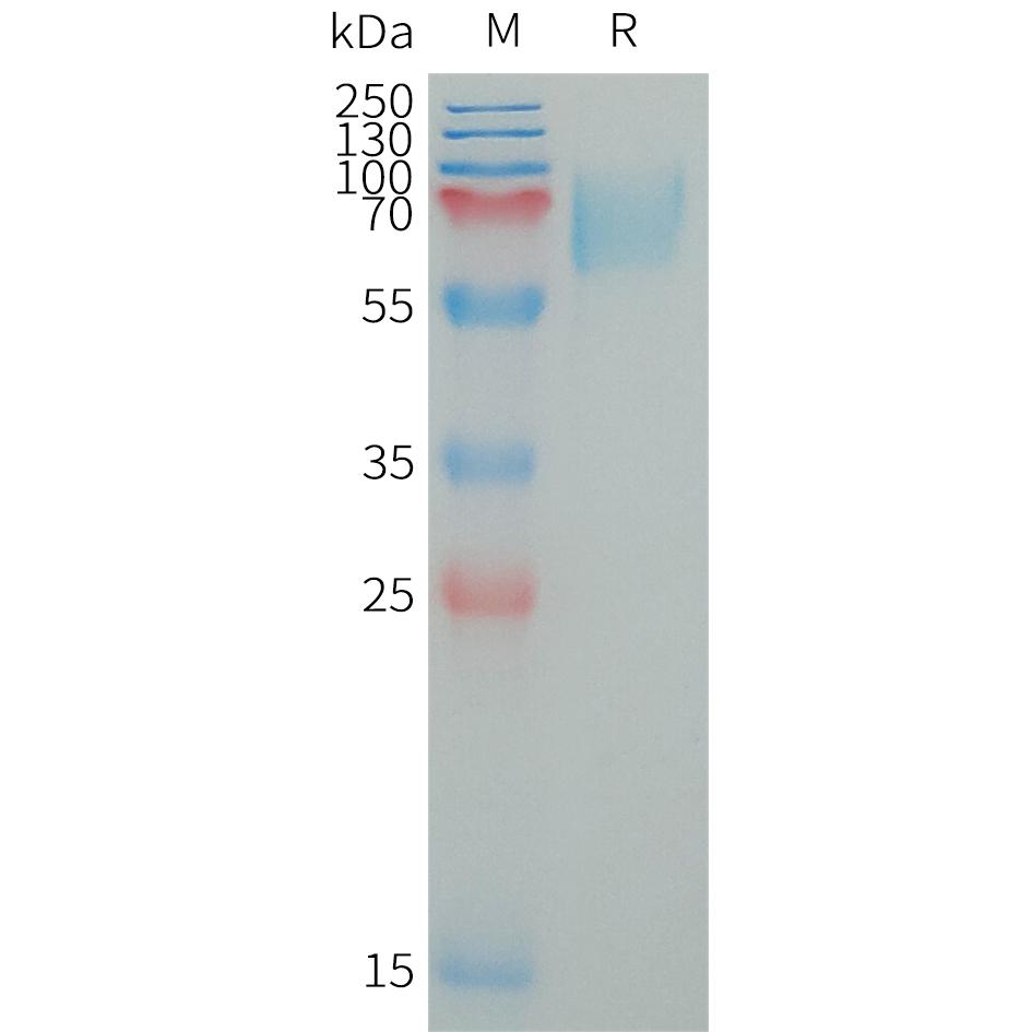 Human LILRA2 Protein, His Tag