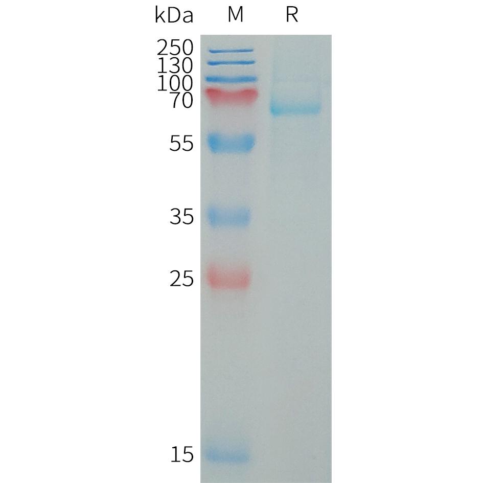 Human LILRB5 Protein, His Tag