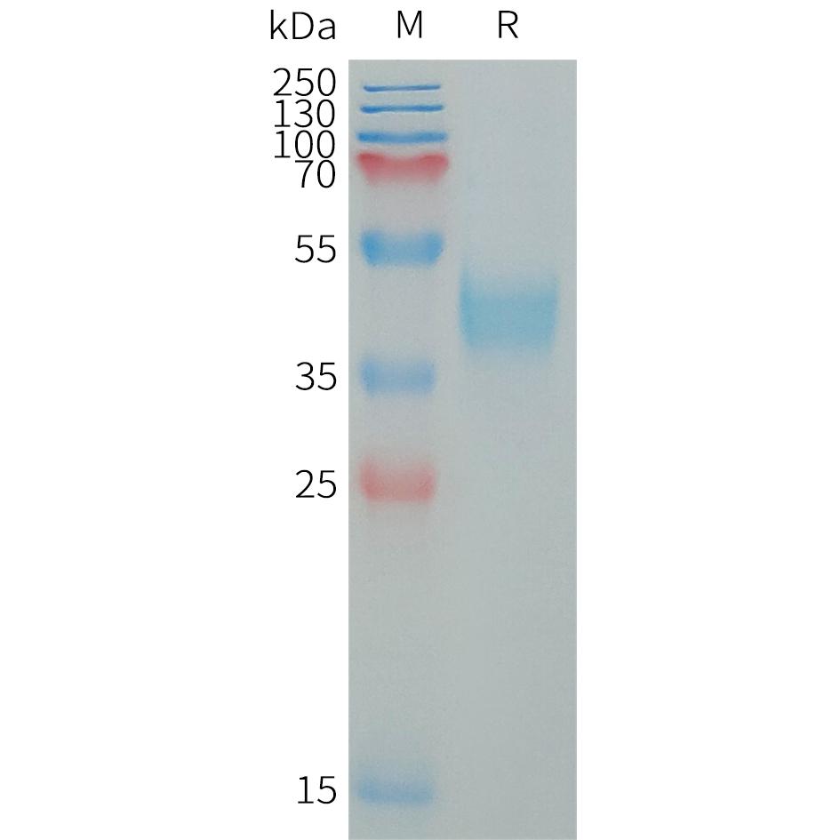 Human MXRA8 Protein, His Tag