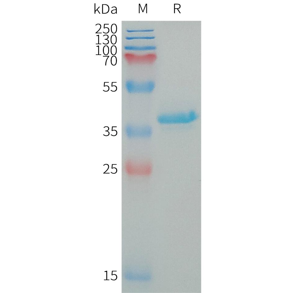 Human IGF1 Protein, hFc Tag