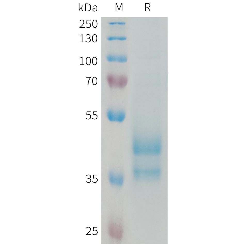 Human CCL24 Protein, hFc Tag