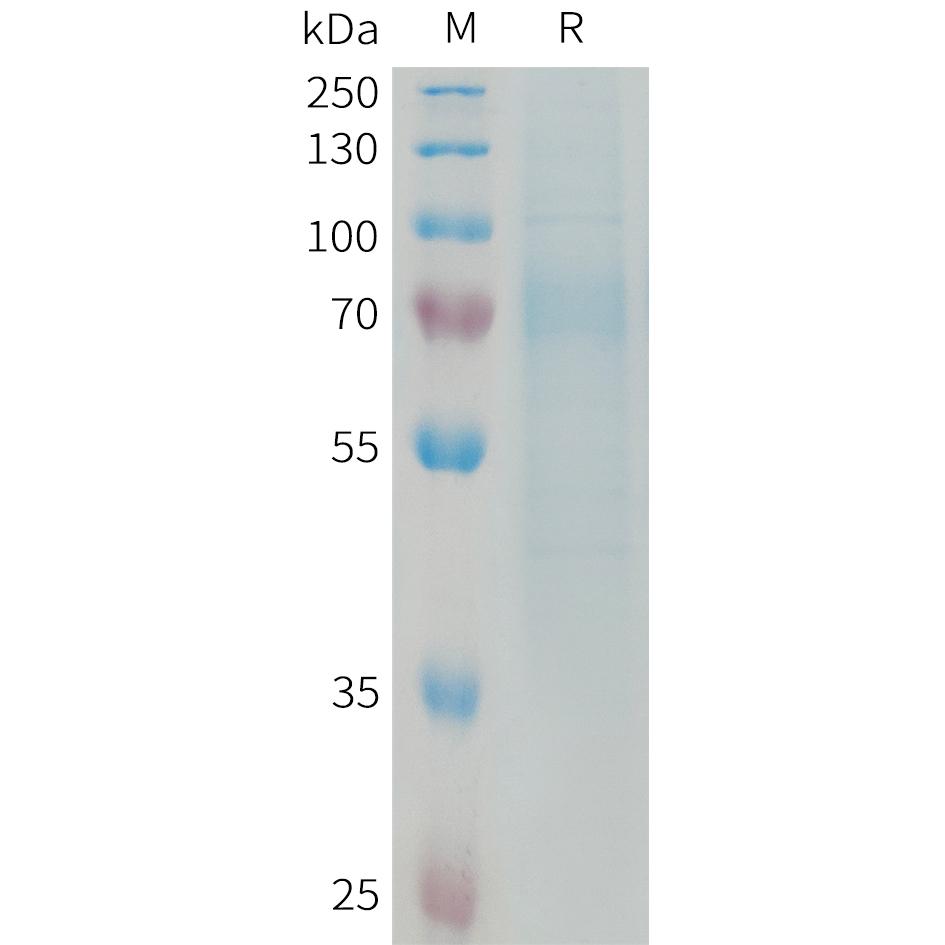 Human RTN4R Protein, His Tag