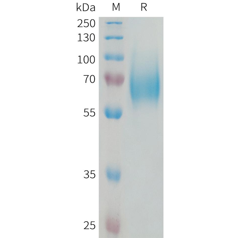 Human FGFR1 Protein, His Tag