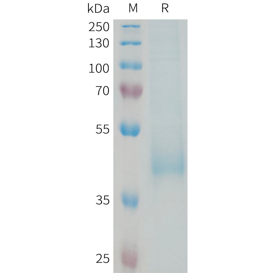 Human KIR3DL3 Protein, His Tag