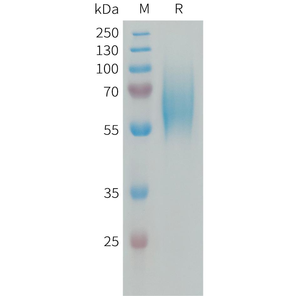 Human FGFR2 Protein, His Tag