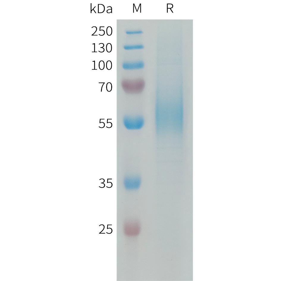 Human MSR1 Protein, His Tag