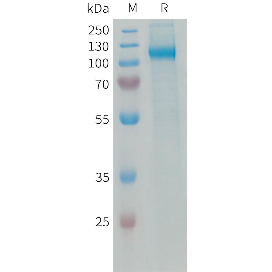 Human AOC3 Protein, His Tag