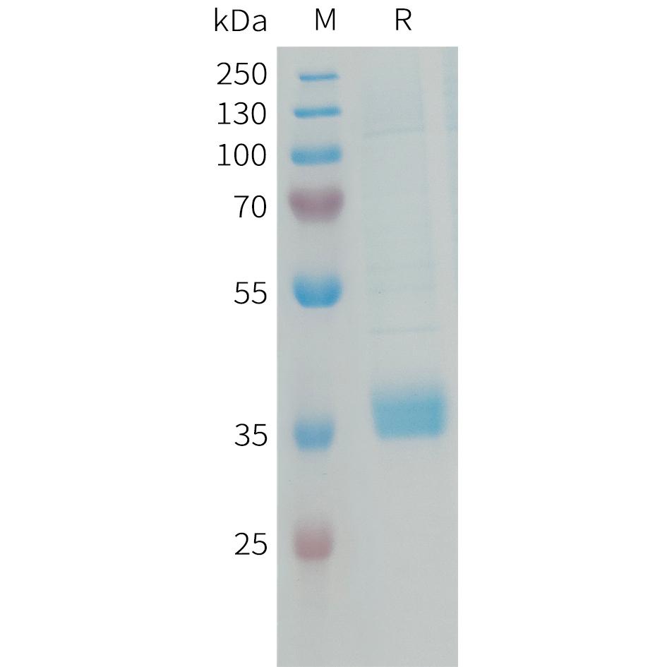 Human MFAP4 Protein, His Tag