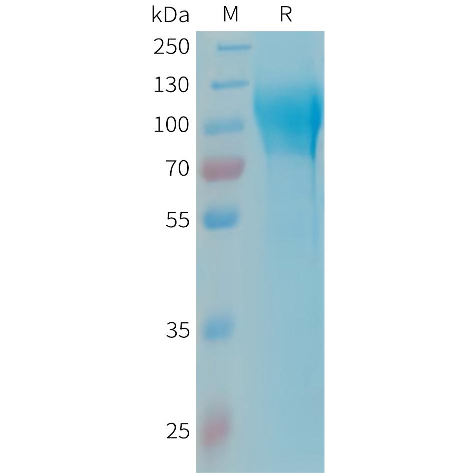 Human MAG Protein, His Tag