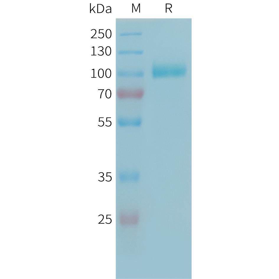 Human C2 Protein, His Tag