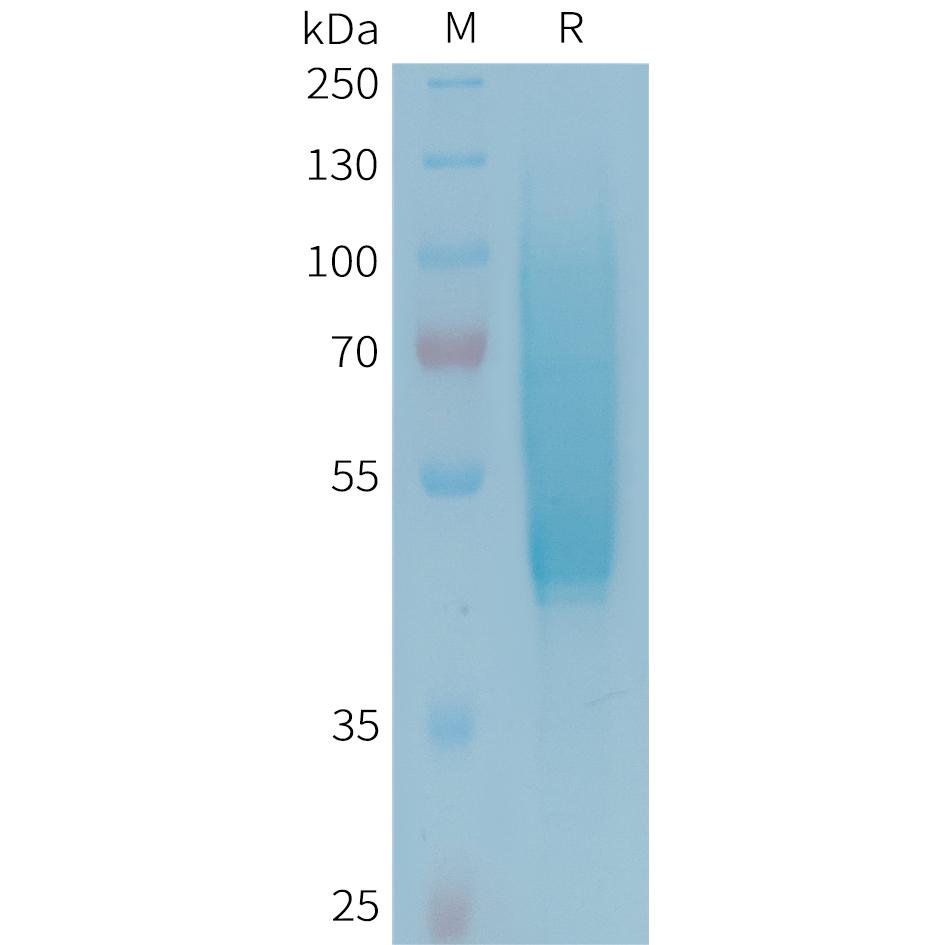 Human CX3CL1 Protein, His Tag