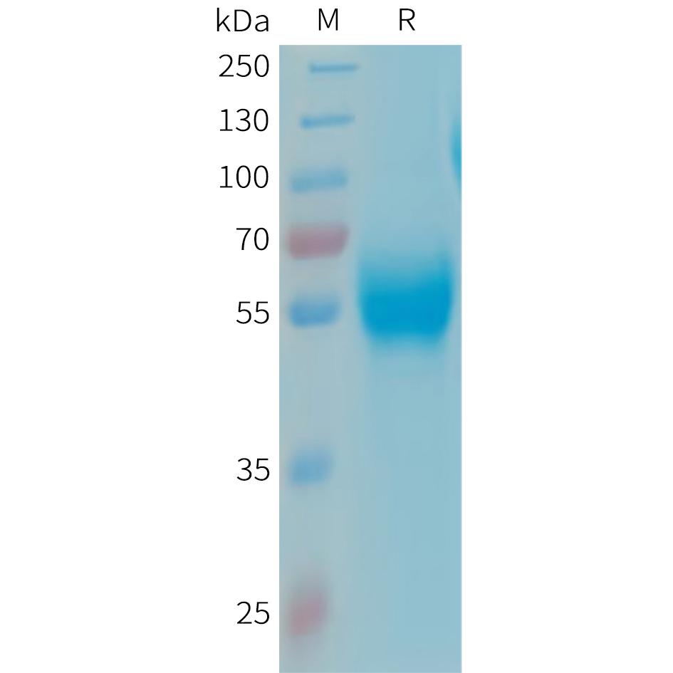 Human APOH Protein, His Tag