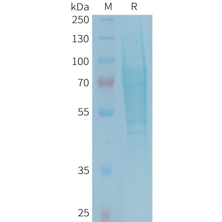 Human TREML2 Protein, His Tag