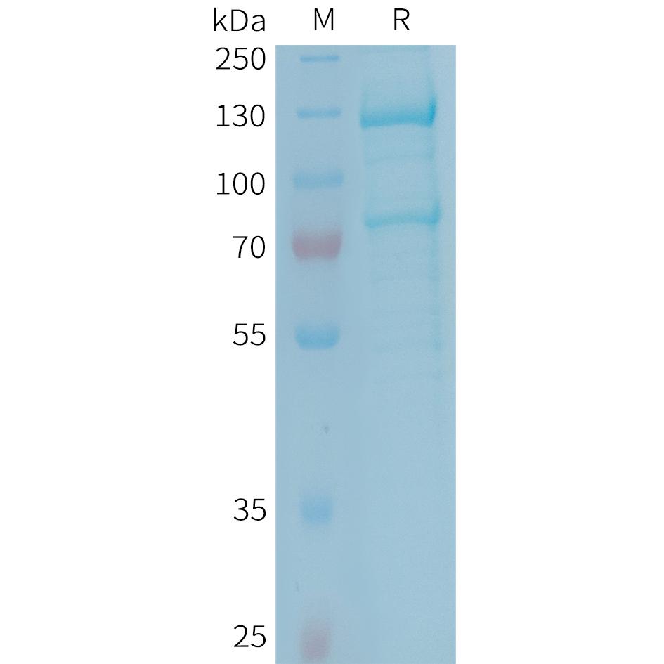 Human C5 Protein, His Tag