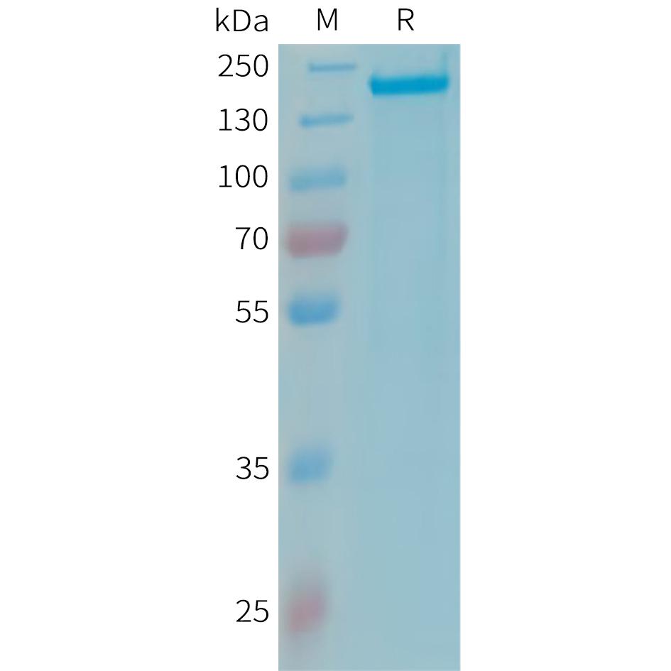 Human CFH Protein, His Tag