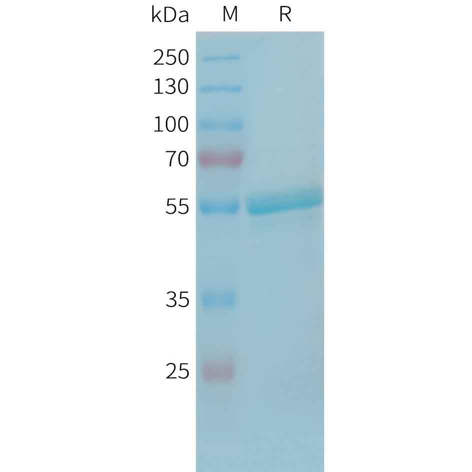 Human TREML1 Protein, hFc Tag