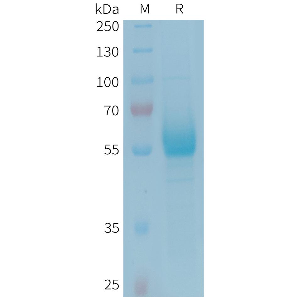 Human CD161 Protein, hFc Tag