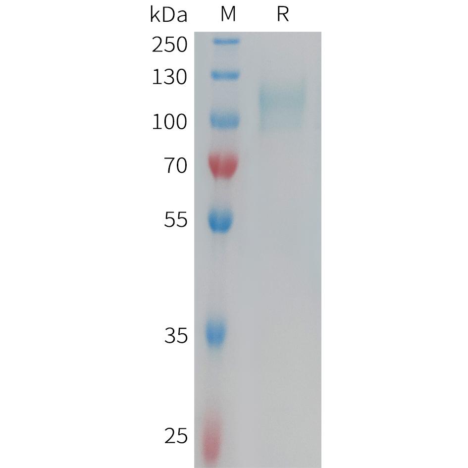 Human CD62E Protein, His Tag