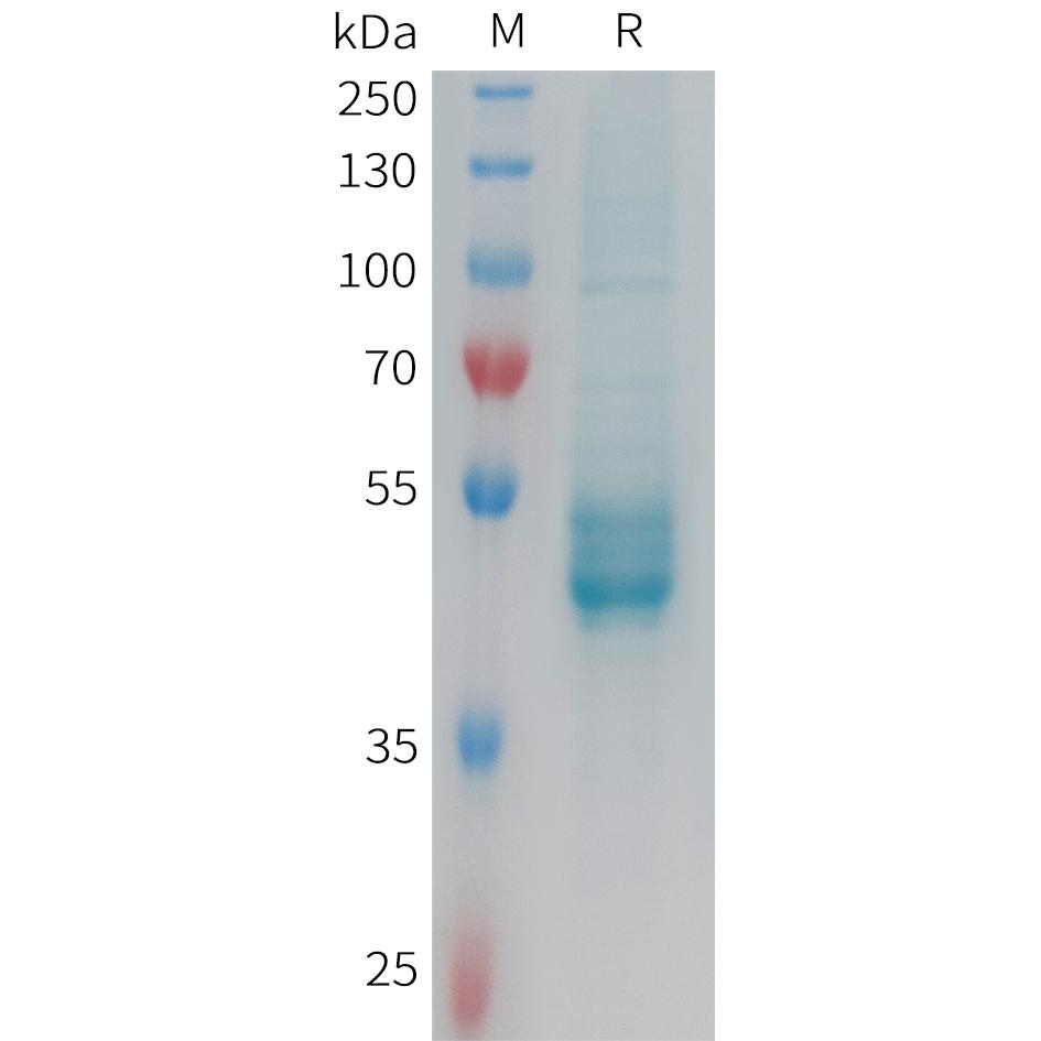 Human IL25 Protein, hFc Tag