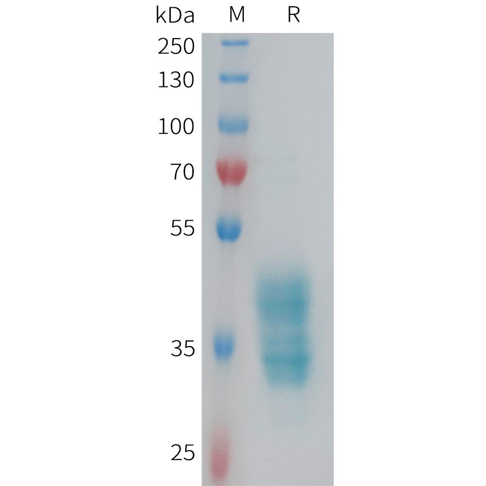 Human F2RL3 Protein, hFc Tag