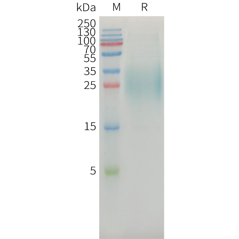 Human MICAa3 Protein, His Tag