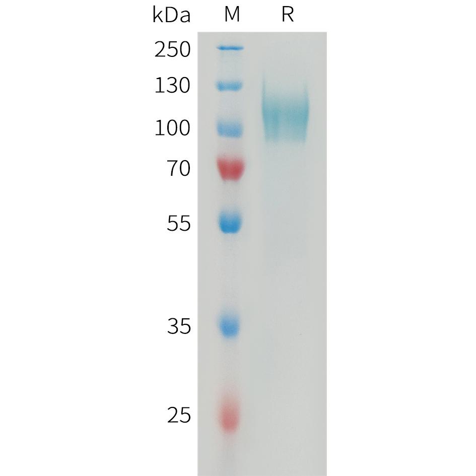 Human PDGFRA Protein, His Tag