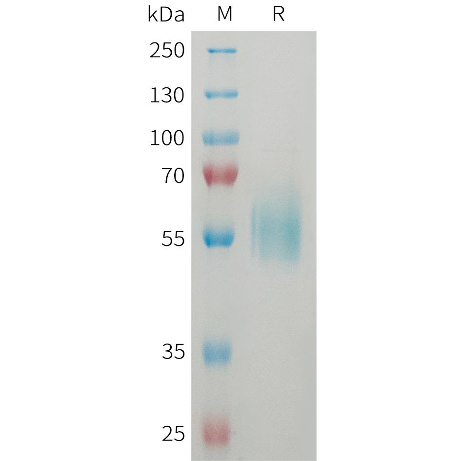 Human ST2 Protein, His Tag