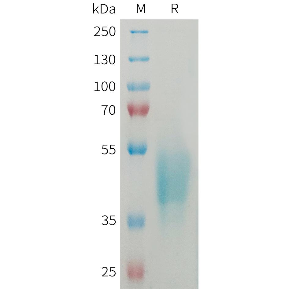 Human OSCAR Protein, His Tag