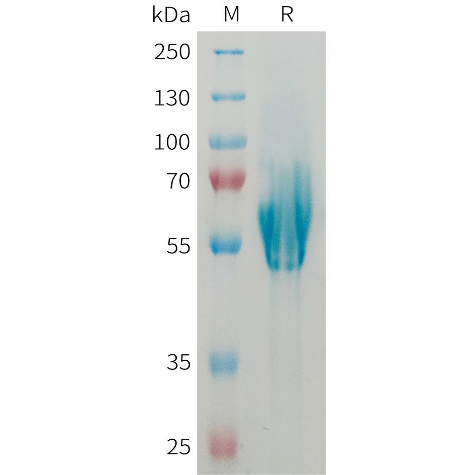 Human MADCAM1 Protein, His Tag