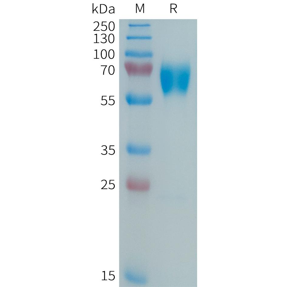 Human MMP8 Protein, His Tag