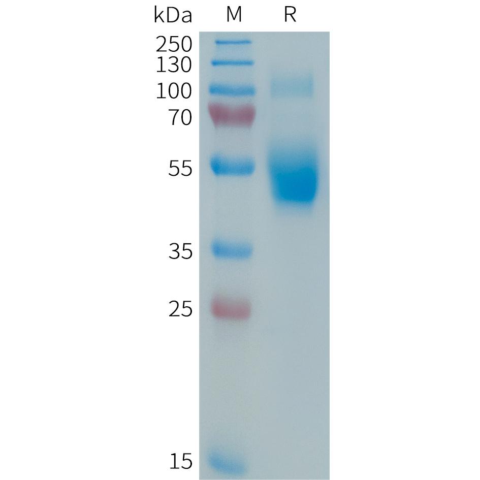 Human IL3 Protein, hFc Tag