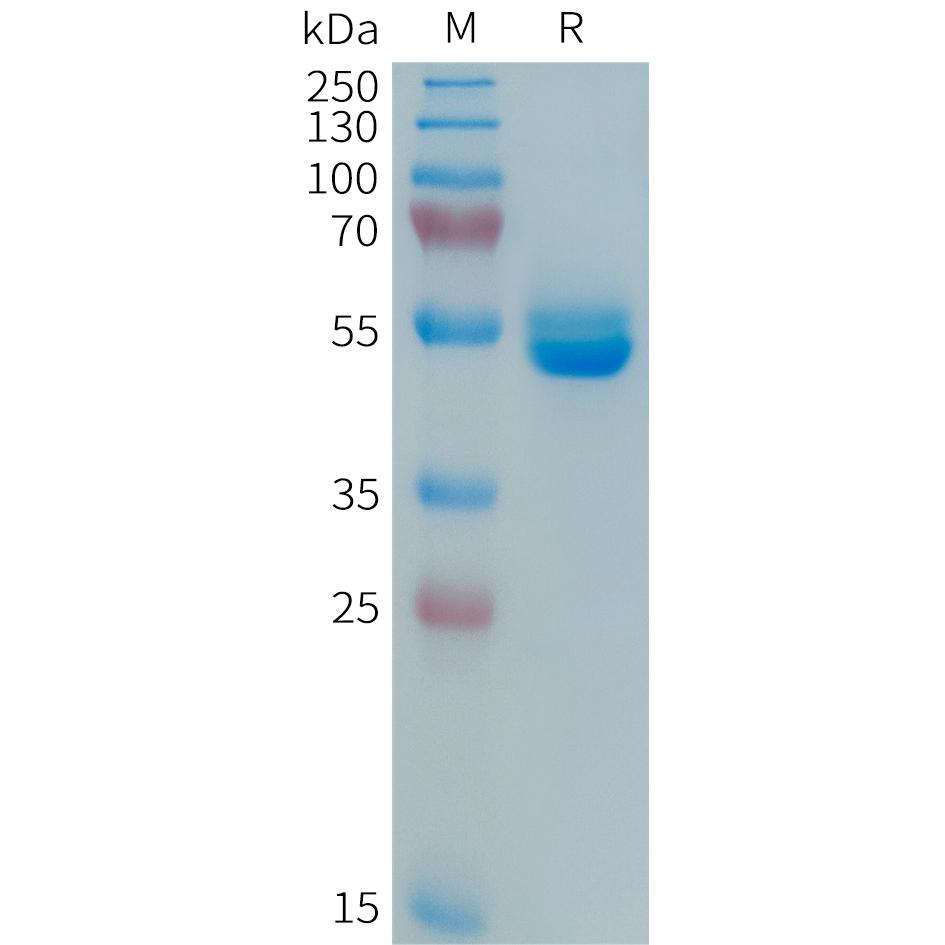 Human PRL Protein, hFc Tag