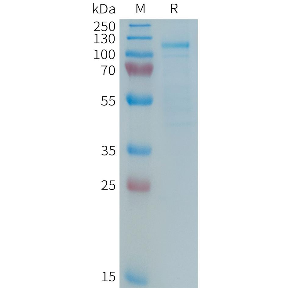 Human LRP5 Protein, hFc Tag