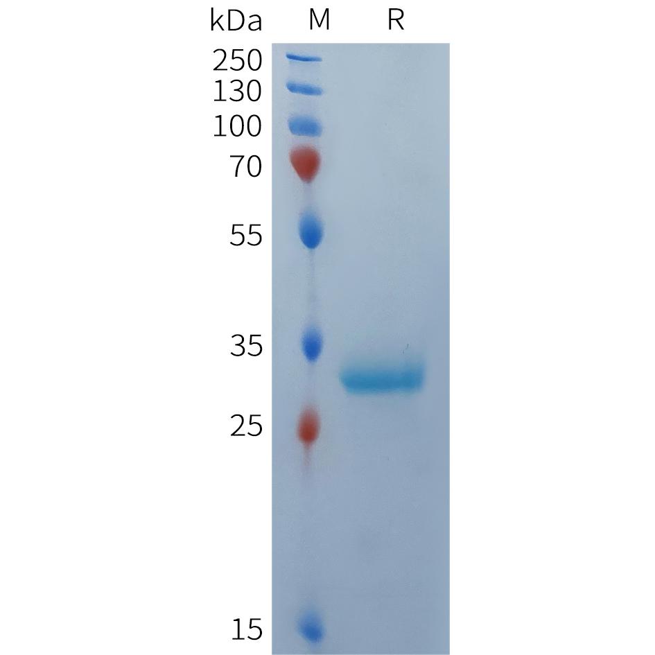 Human BCMA(1-22) Protein, mFc Tag