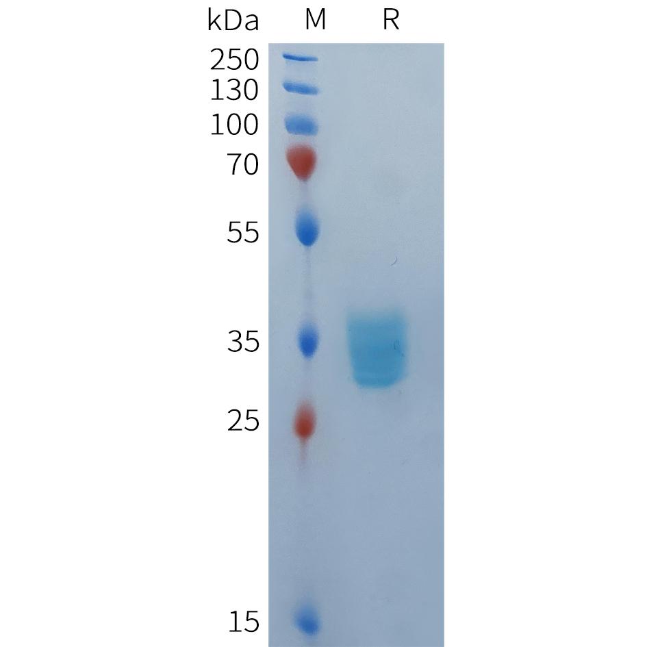 Human BCMA(42-54) Protein, mFc Tag